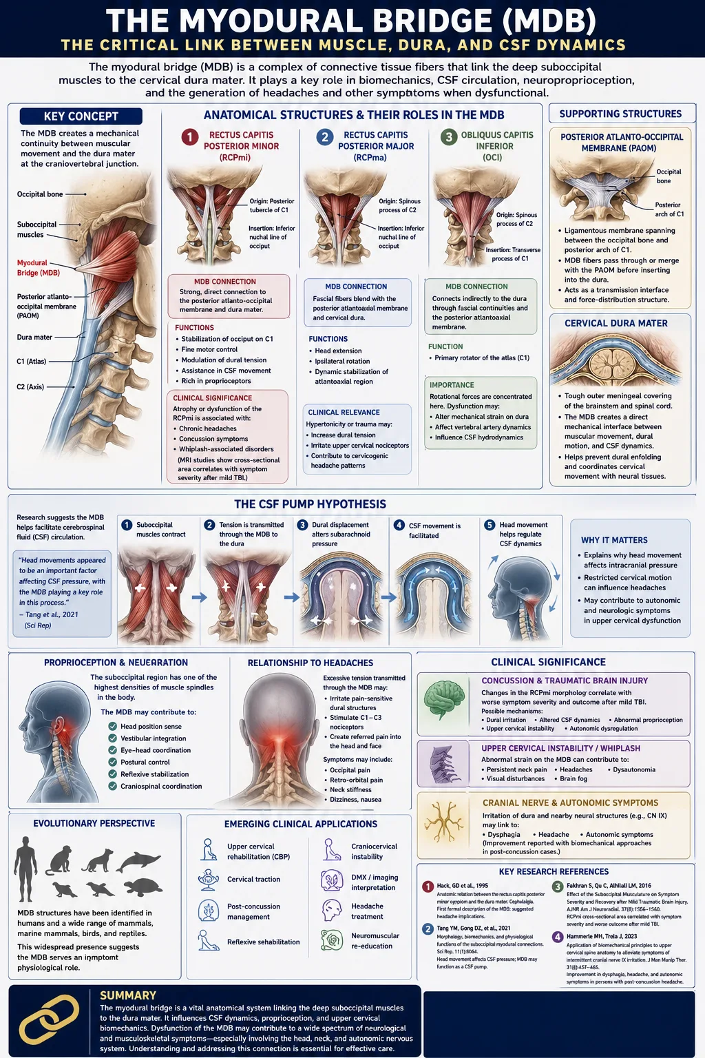 Medical illustration showing the Myodural Bridge connecting upper cervical muscles to the dura mater, explaining the structural cause of tension headaches and migraines